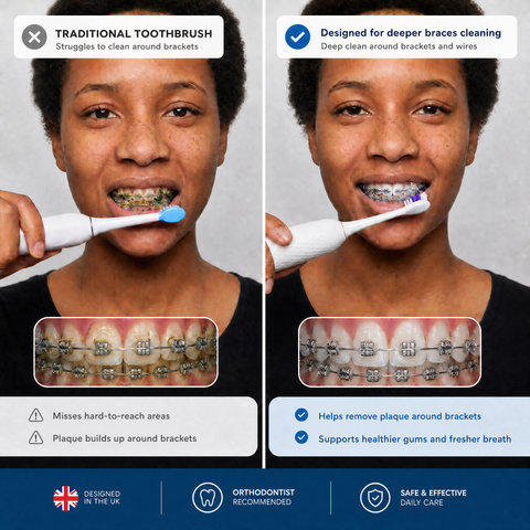 Braces Cleaning Kit | 2-in-1 Sonic Electric Toothbrush & Water Flosser